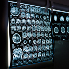 How Clinical Trials Are Becoming More Precise Through Advanced Imaging